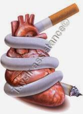 Infarctus du myocarde